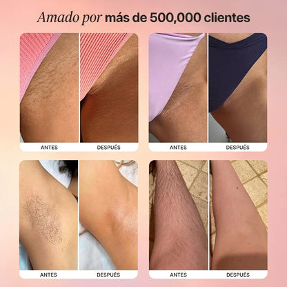 Skinup - Afeita y Depila tus zonas intimas sin cortes